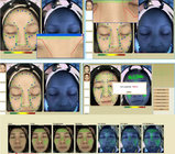 3 डी त्वचाविज्ञान चेहरे की त्वचा विश्लेषण मशीन चेहरे का स्कैनर त्वचा विश्लेषक 40W