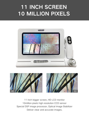 एबीएस पीसी 15 इंच एचडी स्क्रीन 200X कैमरा यूएसबी डिजिटल हेयर एंड स्किन एनालाइजर
